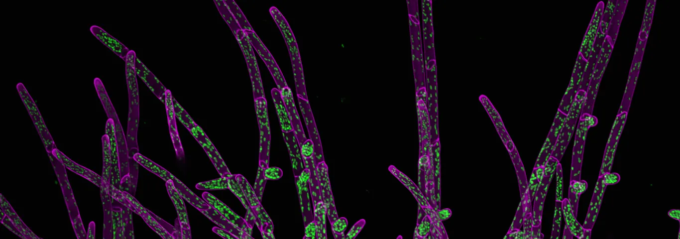 cells on the edge of the moss colony that are spreading. In green is autofluorescence of chlorophyll in chloroplasts and ion magenta its cell wall stained with calcofluor white. By Ivan Radin