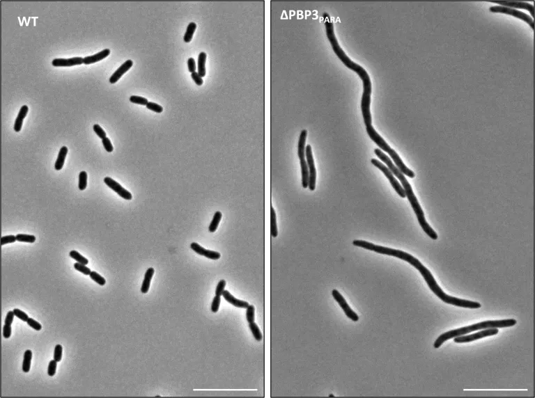 Phase contrast images of wild-type Klebsiella pneumoniae (left) and a PBP3PARA deletion mutant (ΔftsI2, right) growing on acidified nutrient agarose pads (pH 5)
